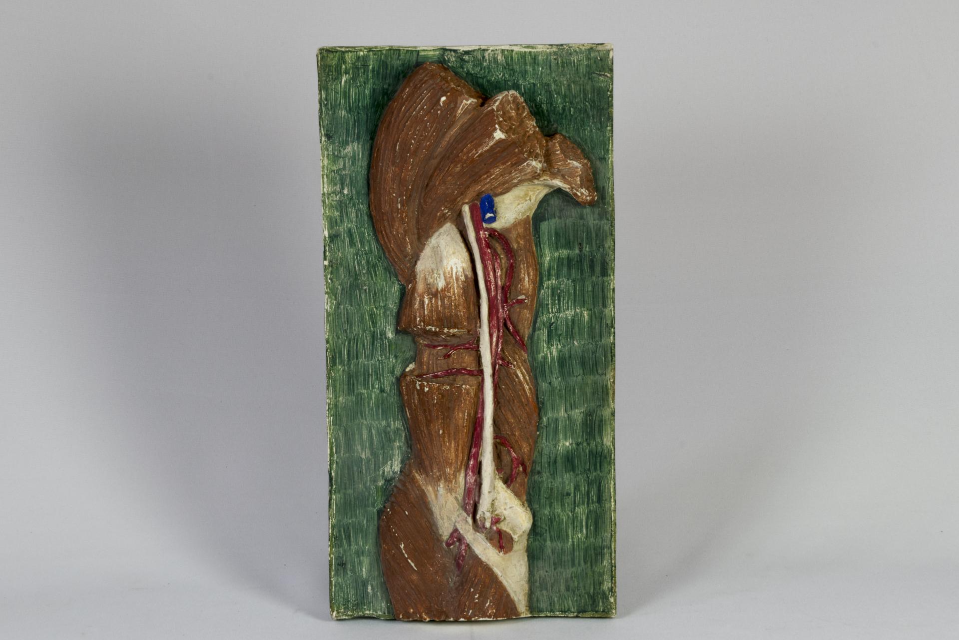 Sección de brazo
