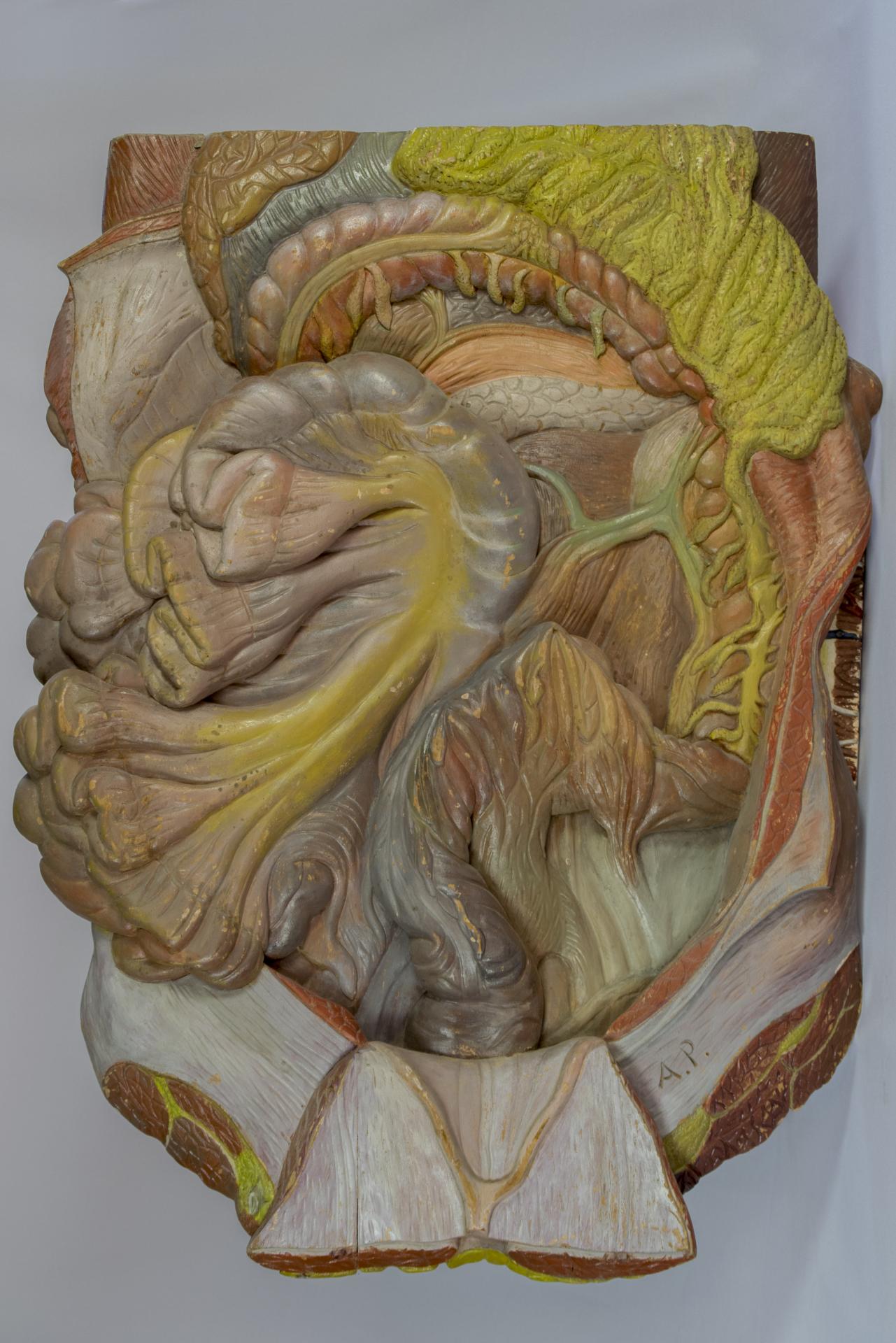 Vísceras abdominales inframesocólicas